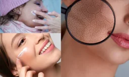 Cilt Nemlendirici Kullanmanın Önemi Nedir?