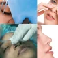 Rinoplasti - تجميل الانف Nedir?